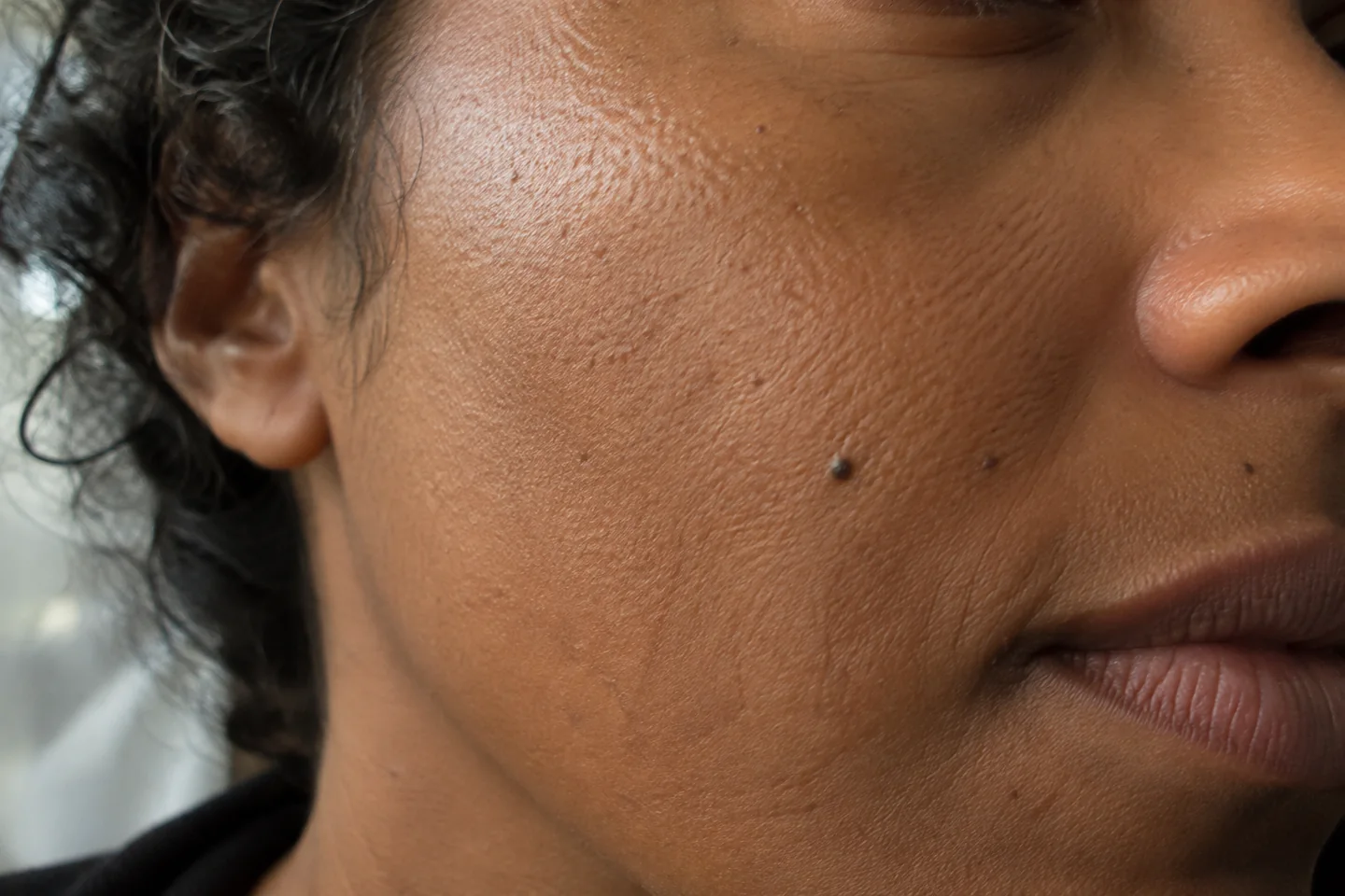 Texture naturelle d’une joue avec pores visibles en lumière latérale douce